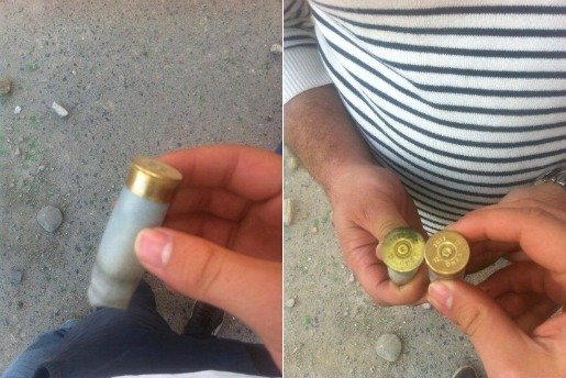 Marche du 20 Avril réprimée à Tizi-Wezzu : un jeune kabyle de 20 ans a perdu un oeil
